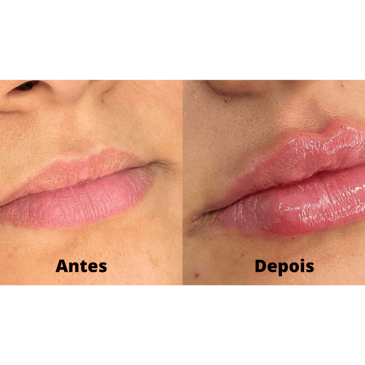 Gloss de Preenchimento Labial Volumizador Derol™ - (Promoção Pague 1 Leve 2)